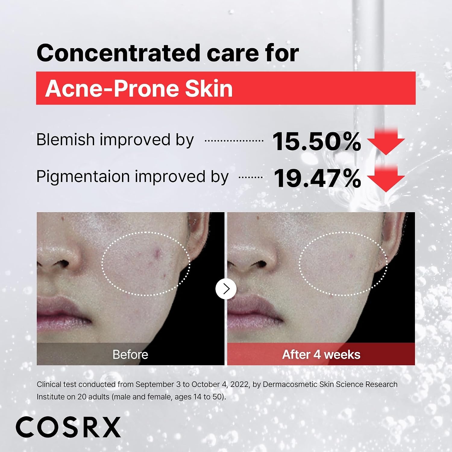 image:imageCOSRX 15 Niacinamide Face Serum 067 fl oz Pore Minimizer Serum for Face Even Skin Tone Korean Skin Care