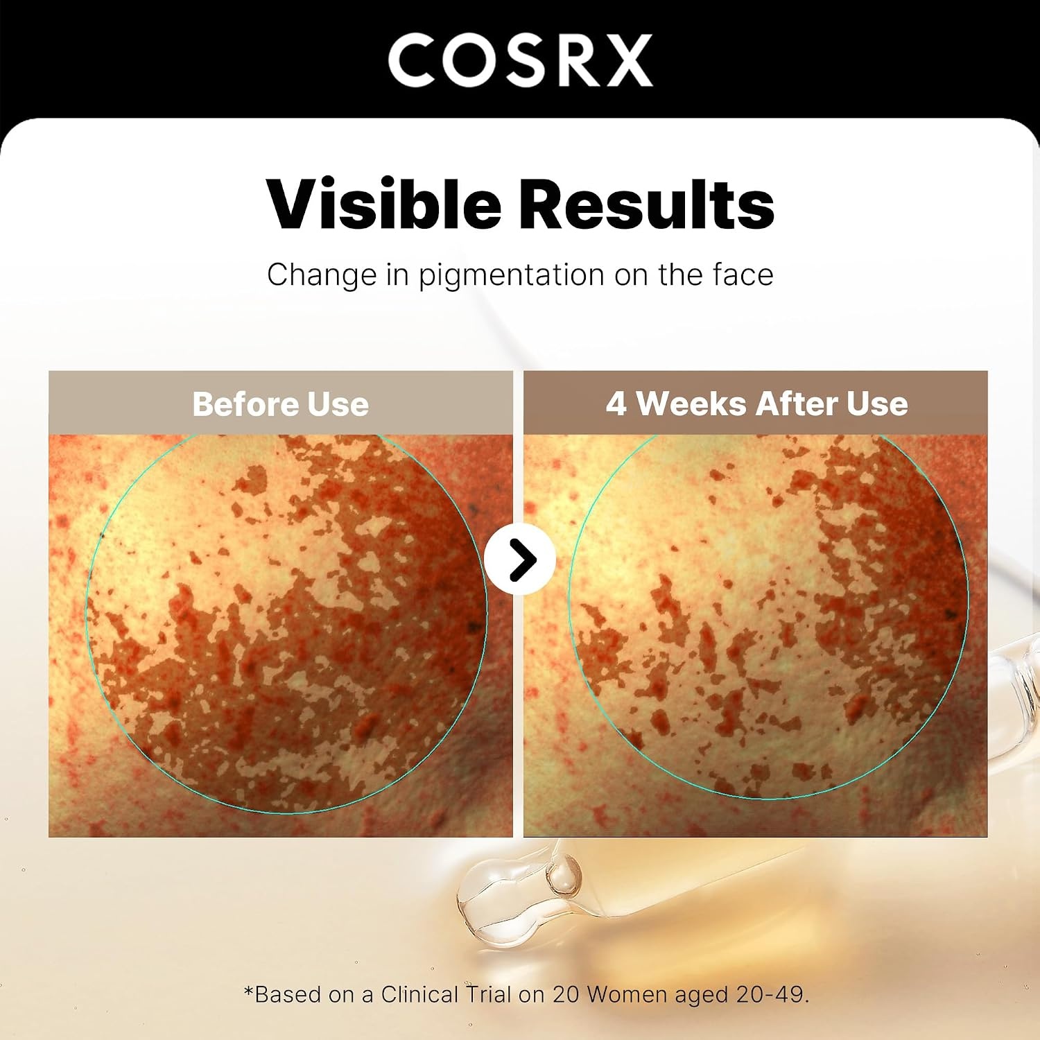 image:imageCOSRX 2 Alpha Arbutin Discoloration Care Serum Dark Spot Care 17 fl oz Niacinamide Glutathione Tranexamic Acid Serum to Target Dark Spots amp Uneven Skin Tone Hyperpigmentation Korean Skin Care
