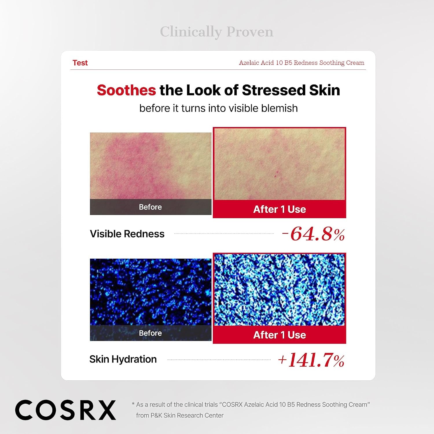image:imageCOSRX Azelaic Acid 10 B5 Redness Soothing Cream Gel 101 fl oz Facial Cream for Redness amp Blemish Care Lightweight amp Hydrating with Centella amp Hyaluronic Acid Korean Skincare