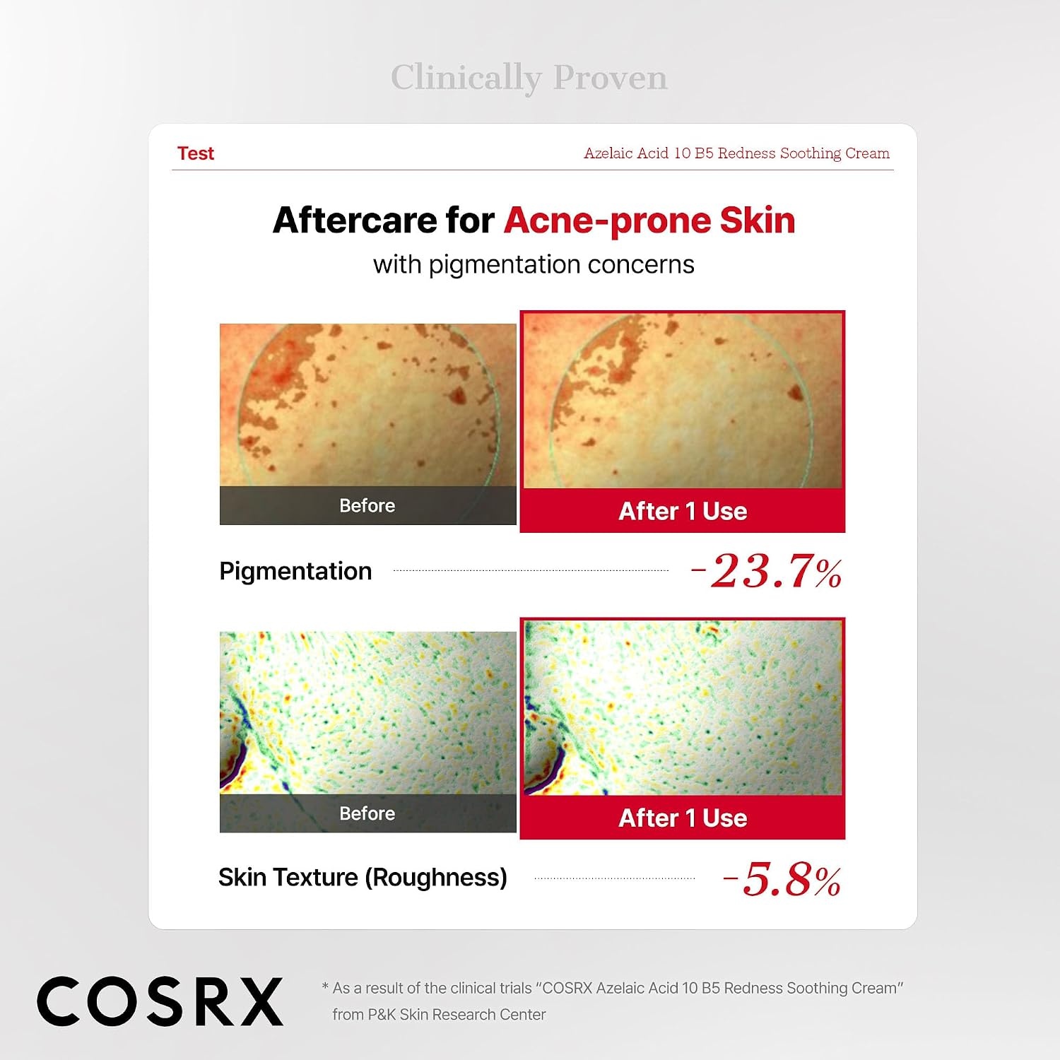 image:imageCOSRX Azelaic Acid 10 B5 Redness Soothing Cream Gel 101 fl oz Facial Cream for Redness amp Blemish Care Lightweight amp Hydrating with Centella amp Hyaluronic Acid Korean Skincare