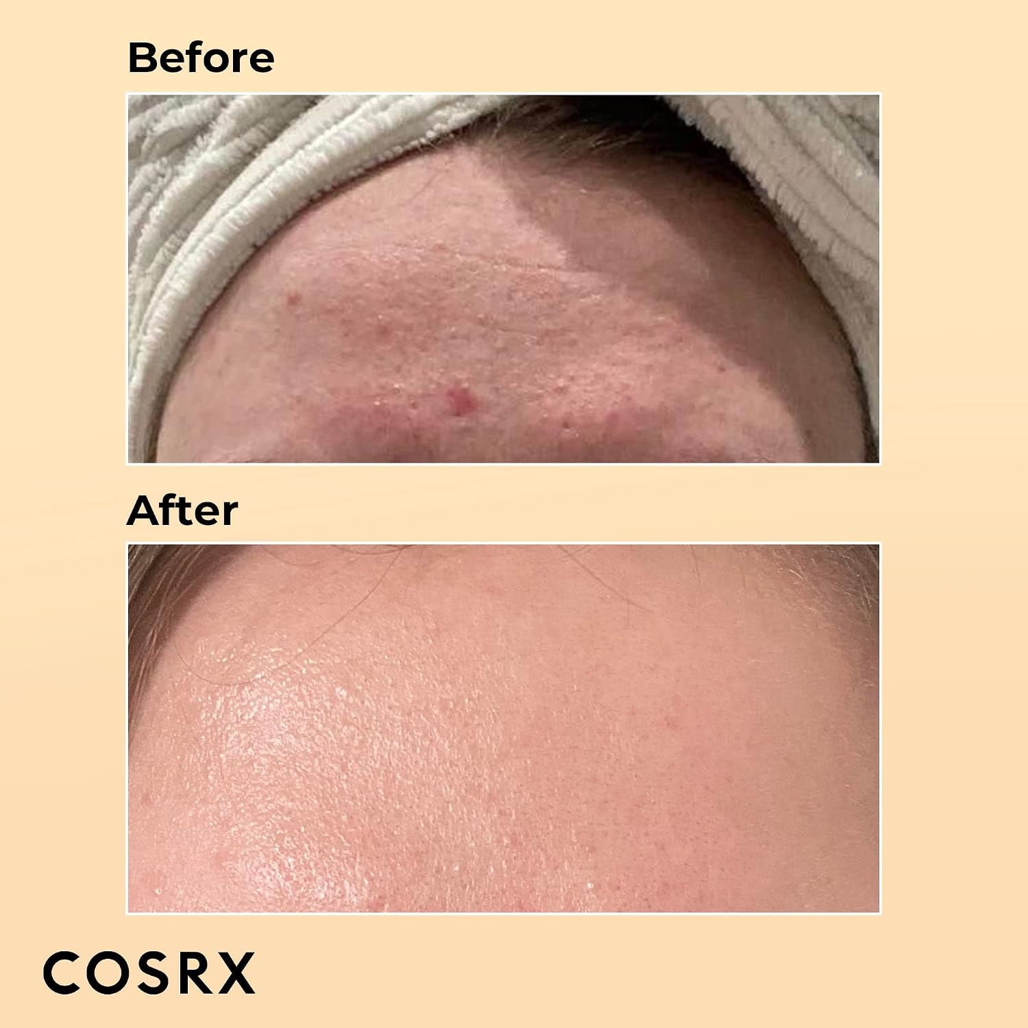 image:imageCOSRX Micellar for Sensitive Skin Snail 96 Mucin Power Essence amp Low pH Niacinamide Micellar Cleansing Water Hydrating Radiating Serum amp Daily Cleanser for Sensitive Skin Korean Skin Care
