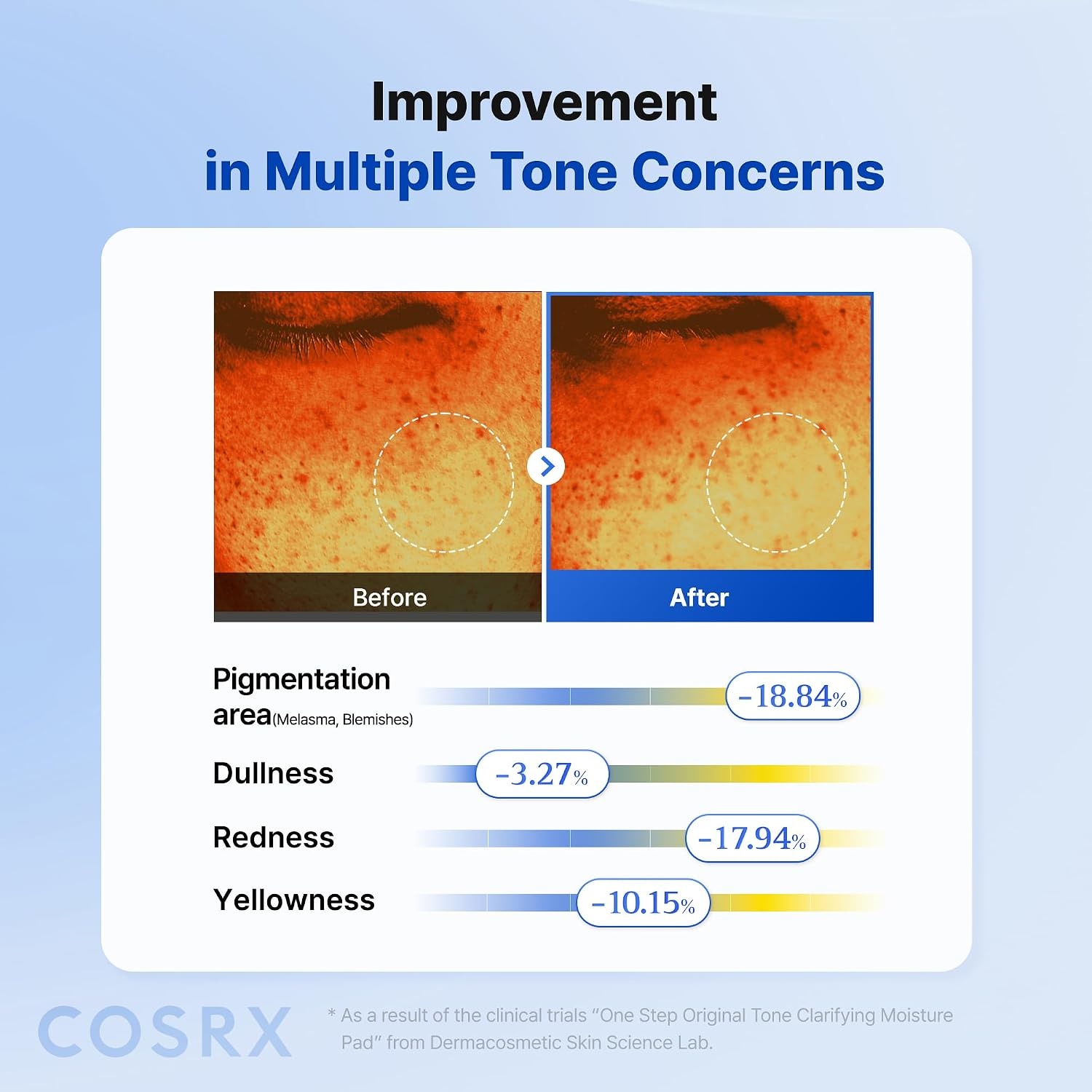 image:imageCOSRX OneStep Tone Clarifying Toner Pads Even Skin amp Hydration 100 Pads Toning Pad for Skin Texture amp Hydration amp Evening Skin Tone with Arbutin Glutathione amp Hyaluronic Acids Korean Skin CareTone Clarifying Moisture