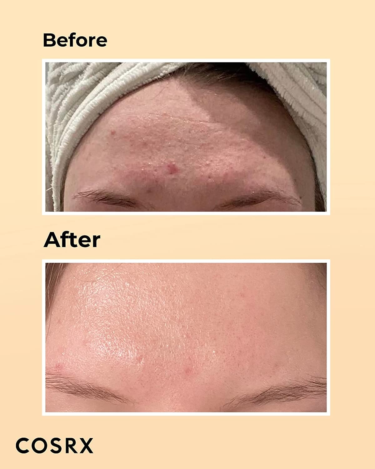 image:imageCOSRX Post Acne Mark Recovery Snail Mucin 96 Essence Vitamin C 13 Serum Intensive Hydrating for Fine lines Hyperpigmentation After Blemish Care