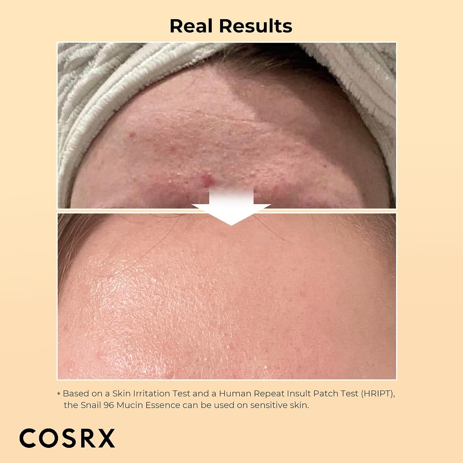 image:imageCOSRX Snail Mucin Duo Snail 92 Cream amp Snail 96 Essence Daily Face Gel Moisturizer and Hydrating Serum for Face with Snail Secretion Filtrate Korean Skin Care