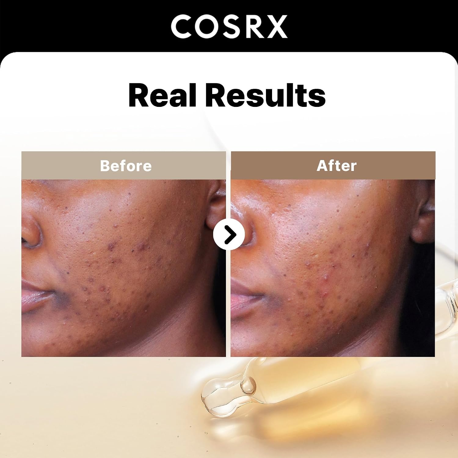 image:imageCOSRX Vitamin E Vitalizing Face Sunscreen SPF 50 2 Alpha Arbutin Discoloration Care Serum